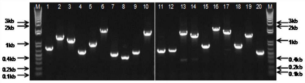 一種棘阿米巴特異性抗原肽、多克隆抗體及其用途